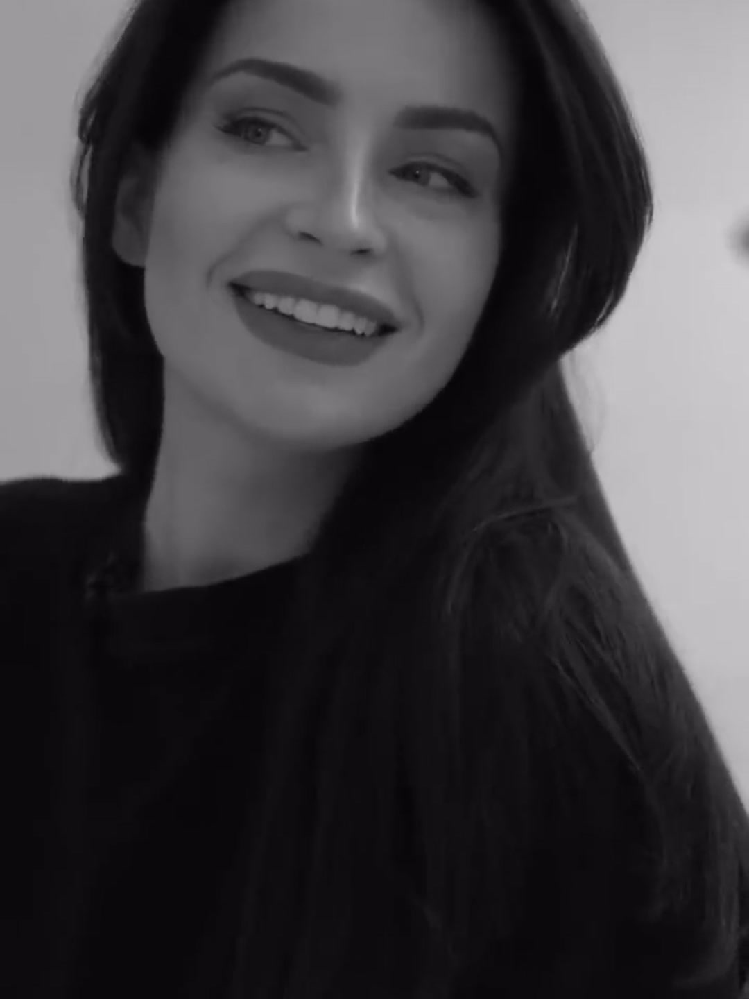 مريضة تبتسم بعد العمل بالقشور الخزفية