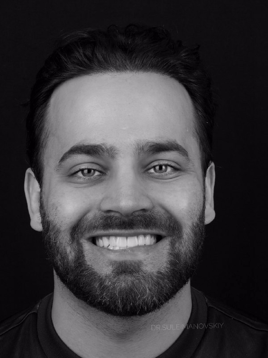 مريض يبتسم أمام الكاميرا ويظهر الصف العلوي كاملًا